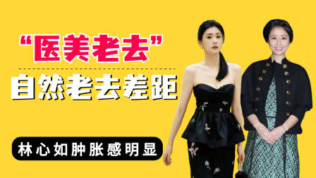 医美老去和自然老去差距？林心如肿胀明显，贾静雯完全就是逆生长